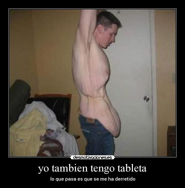 yo tambien tengo tableta - lo que pasa es que se me ha derretido