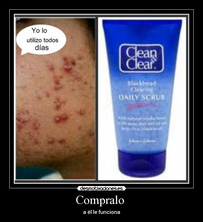 Compralo - a él le funciona