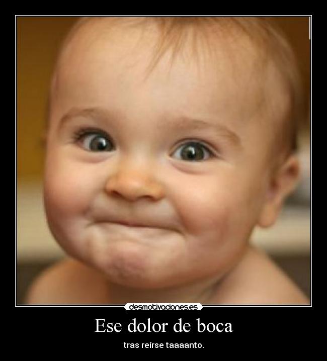 Ese dolor de boca - tras reírse taaaanto.