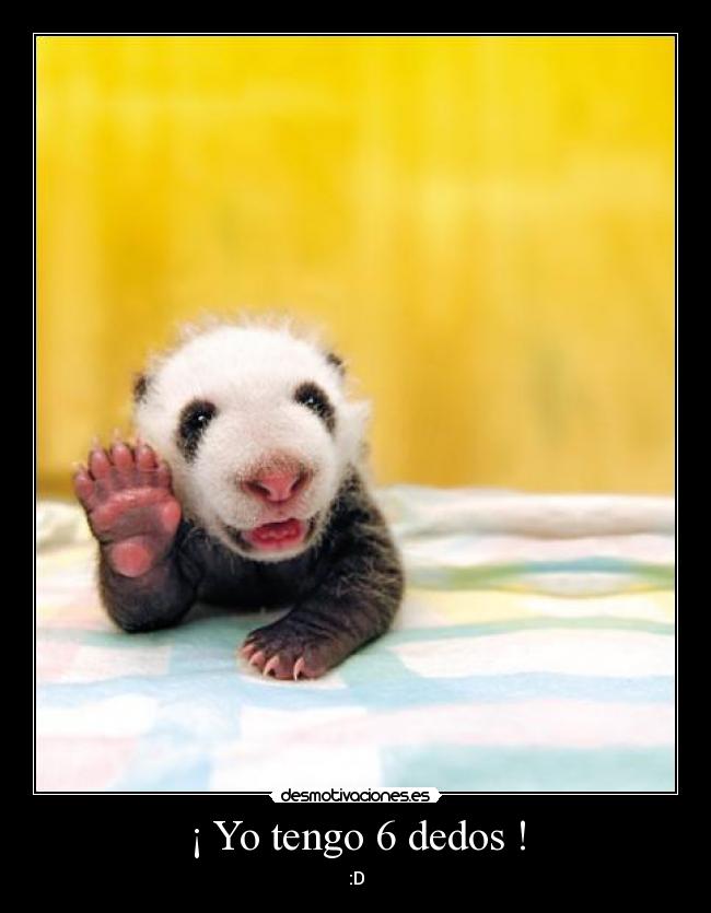 ¡ Yo tengo 6 dedos ! - 