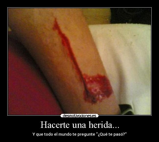 Hacerte una herida... - Y que todo el mundo te pregunte ¿Qué te pasó?