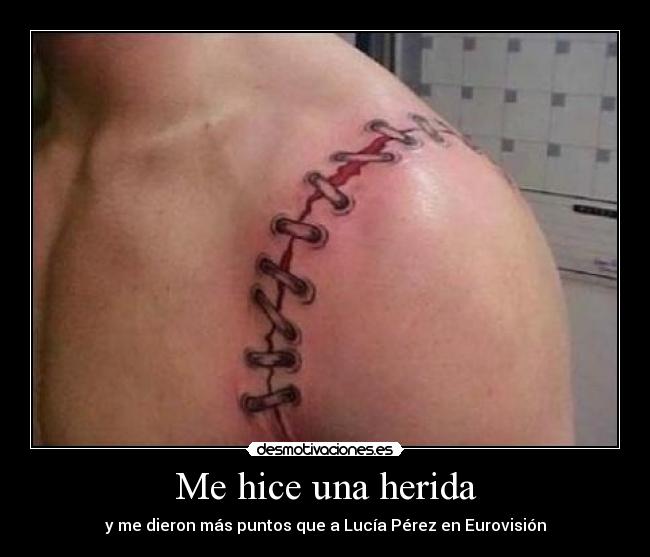 Me hice una herida - y me dieron más puntos que a Lucía Pérez en Eurovisión