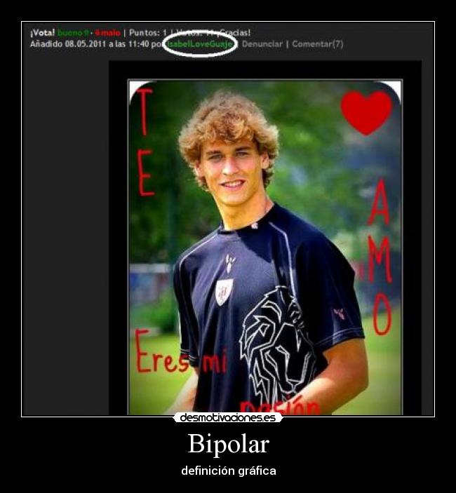 Bipolar - definición gráfica