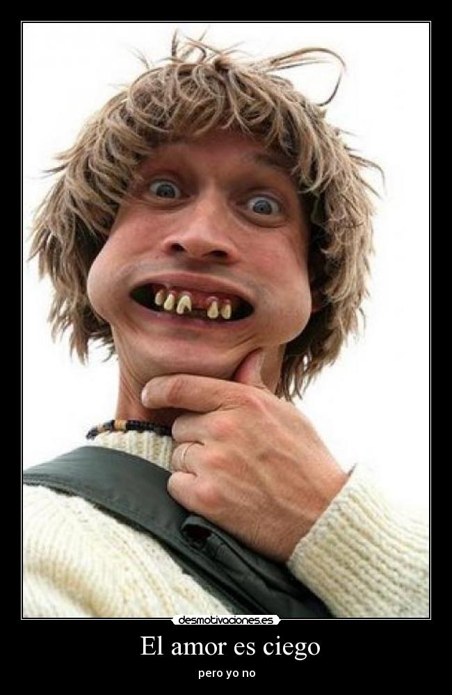  El amor es ciego - 