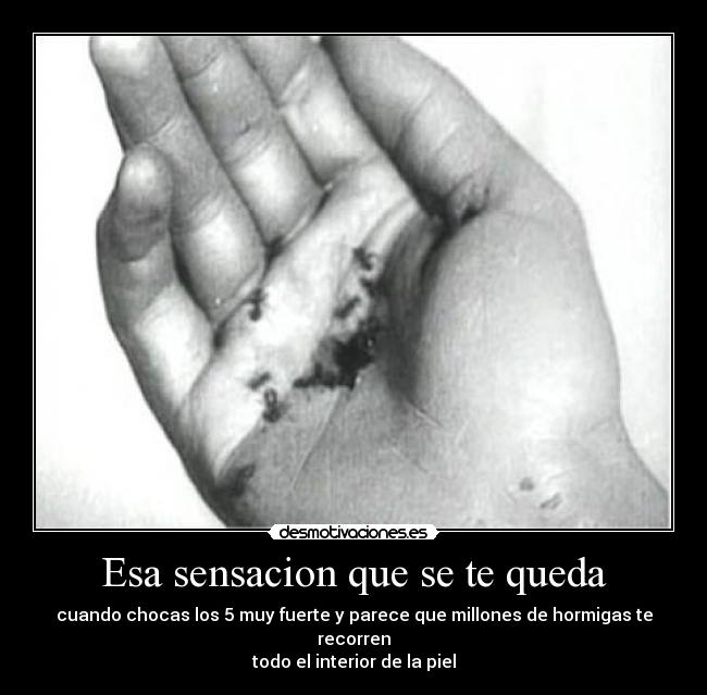 Esa sensacion que se te queda - cuando chocas los 5 muy fuerte y parece que millones de hormigas te recorren
todo el interior de la piel