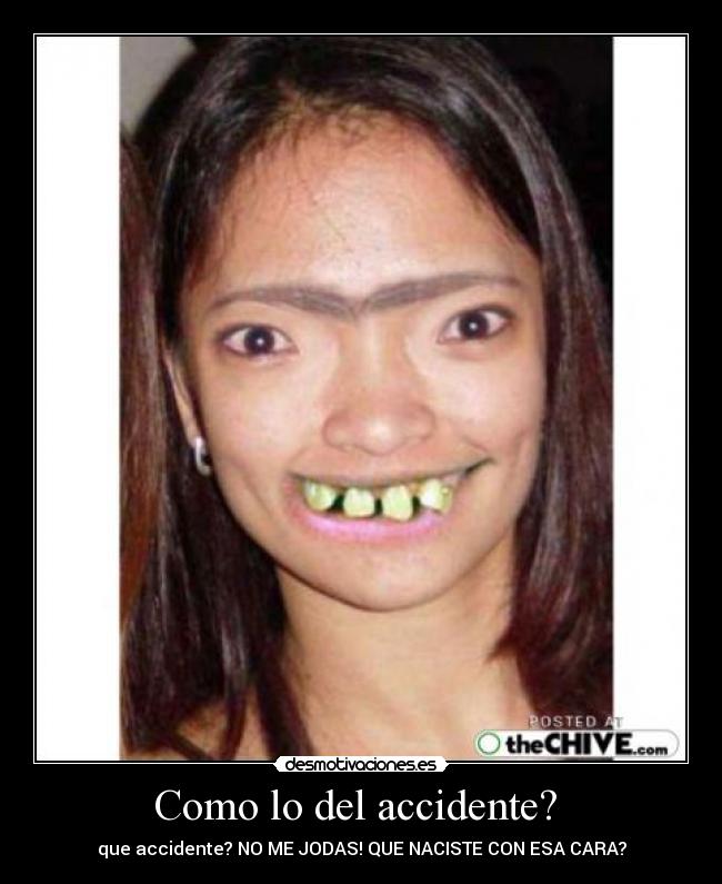 Como lo del accidente? -
