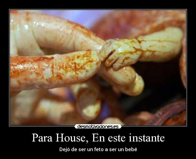 Para House, En este instante - Dejó de ser un feto a ser un bebé