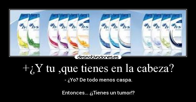 +¿Y tu ,que tienes en la cabeza? - - ¿Yo? De todo menos caspa.
Entonces... ¿¡Tienes un tumor!?