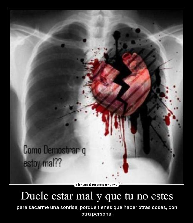 Duele estar mal y que tu no estes - para sacarme una sonrisa, porque tienes que hacer otras cosas, con otra persona.