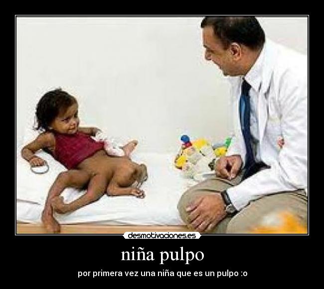 niña pulpo - 