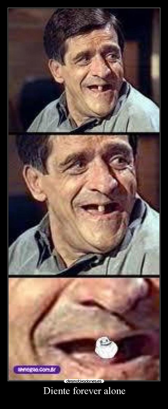 Diente forever alone - 