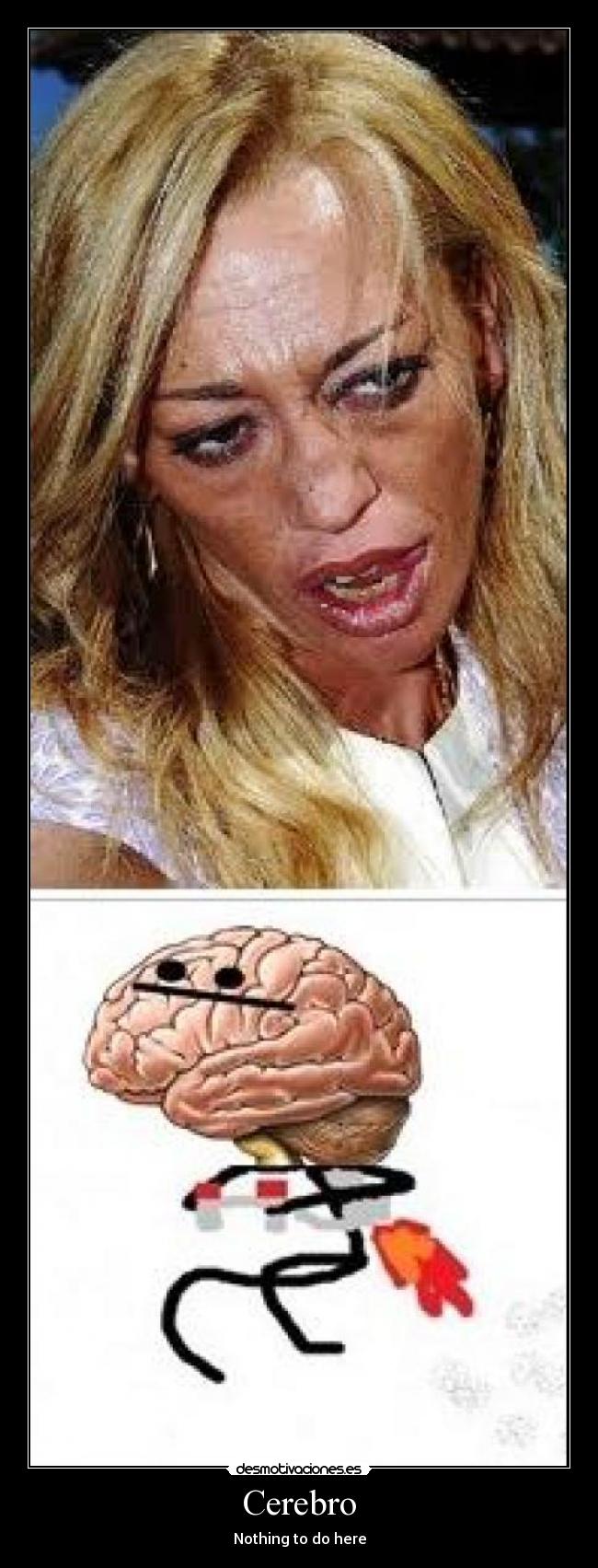 Cerebro - Nothing to do here