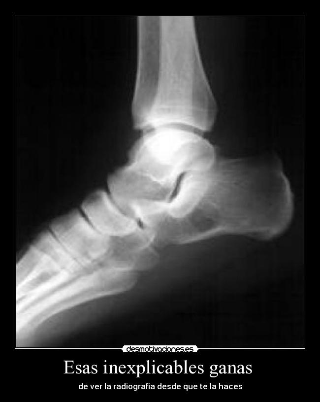 Esas inexplicables ganas - de ver la radiografia desde que te la haces