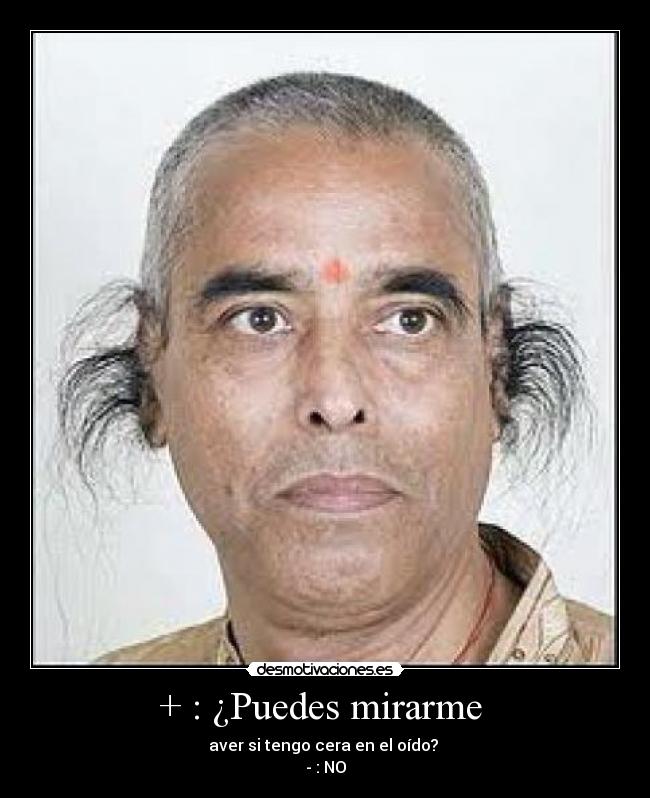 + : ¿Puedes mirarme  - aver si tengo cera en el oído? 
- : NO