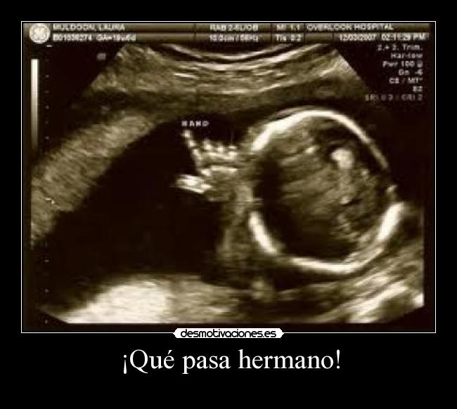 ¡Qué pasa hermano! -