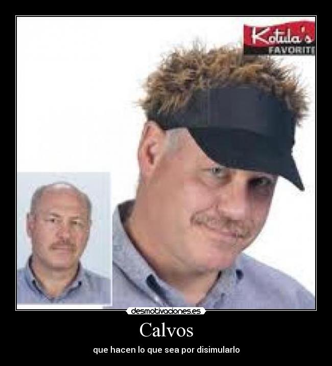 Calvos - 