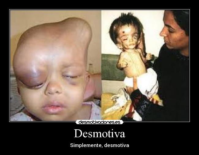 Desmotiva - Simplemente, desmotiva