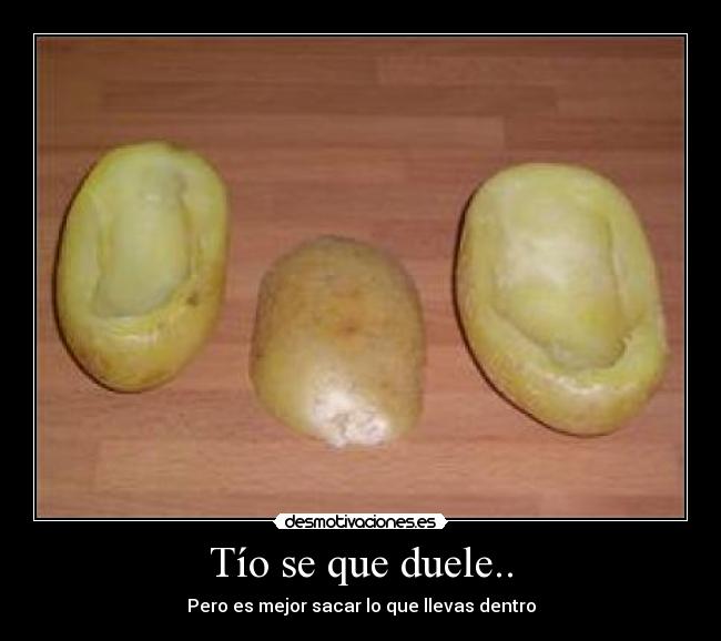 Tío se que duele.. - 