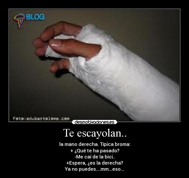 Te escayolan.. -