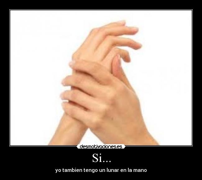 Si... - yo tambien tengo un lunar en la mano