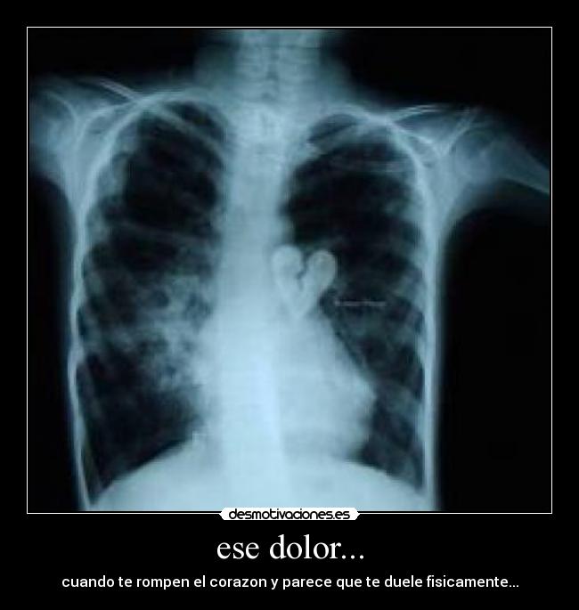 ese dolor... -
