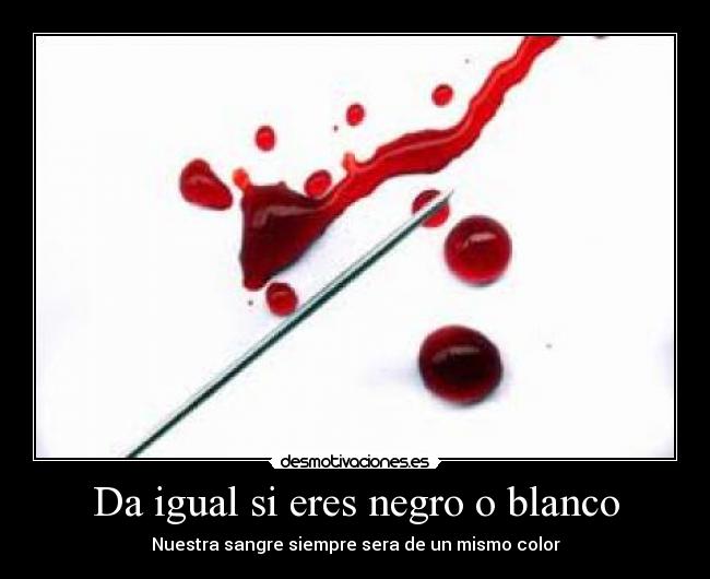 Da igual si eres negro o blanco - 