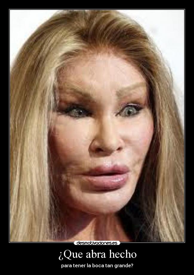 ¿Que abra hecho - para tener la boca tan grande?
