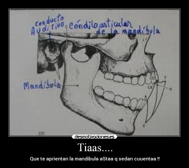 Tiaas.... - Que te aprientan la mandibula aStaa q sedan cuuentaa !!
