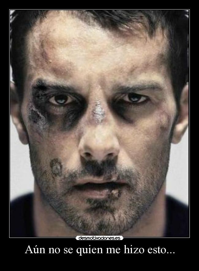 Aún no se quien me hizo esto... - 