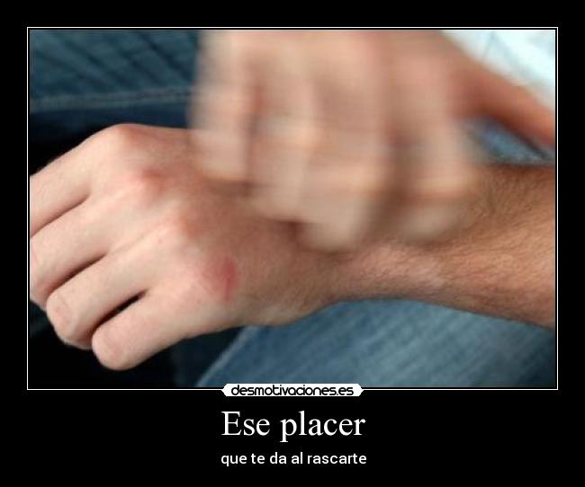 Ese placer - que te da al rascarte