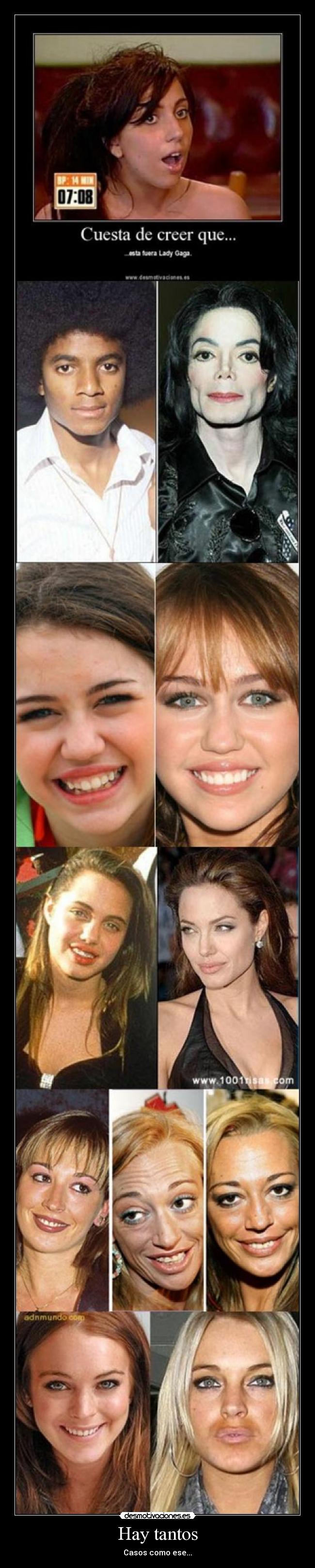 Hay tantos - Casos como ese...