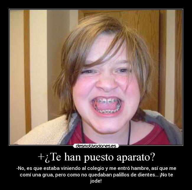 +¿Te han puesto aparato? -