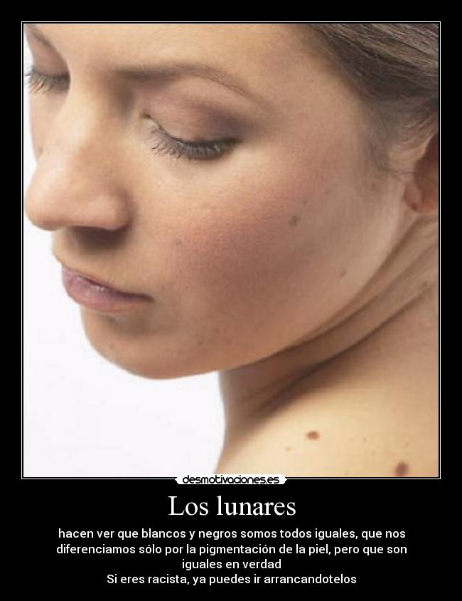 Los lunares -