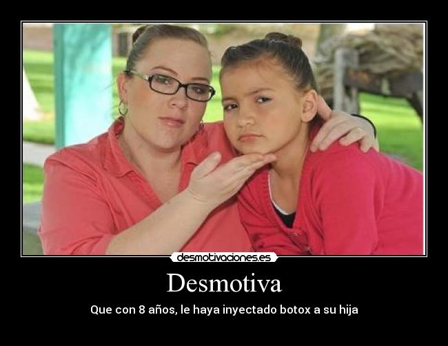 Desmotiva - Que con 8 años, le haya inyectado botox a su hija