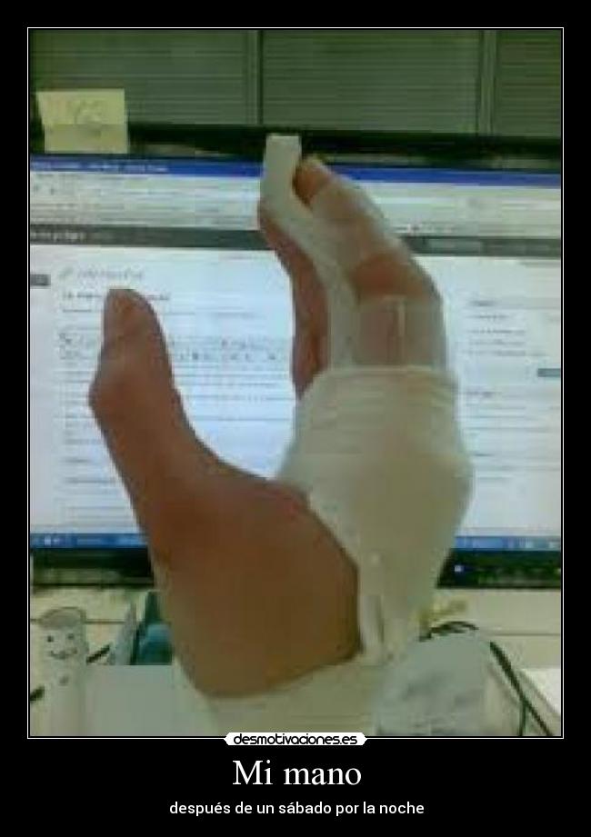 Mi mano - después de un sábado por la noche