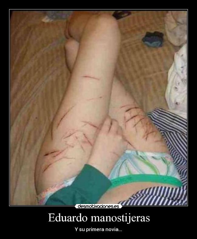 Eduardo manostijeras -