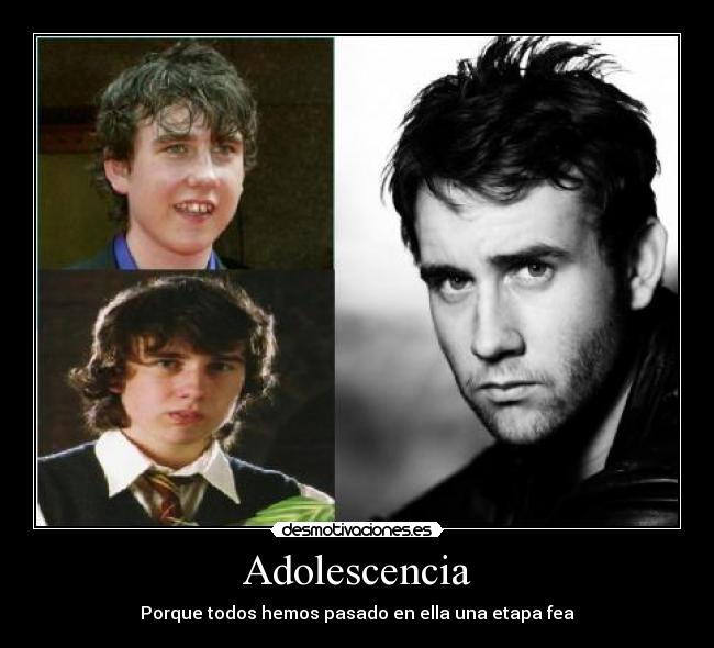 Adolescencia - Porque todos hemos pasado en ella una etapa fea