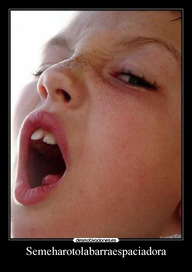 Semeharotolabarraespaciadora - 