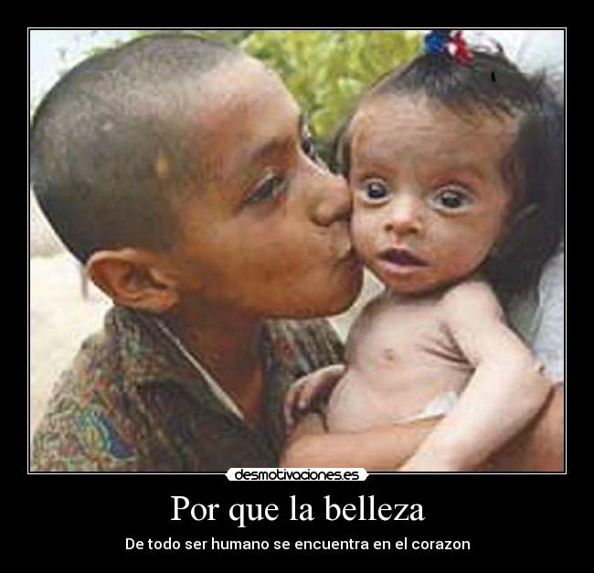 Por que la belleza - De todo ser humano se encuentra en el corazon