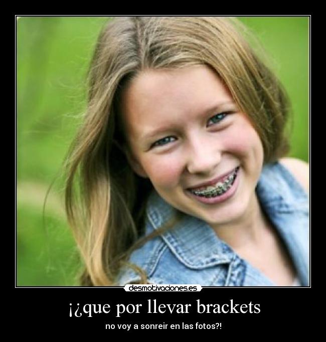 ¡¿que por llevar brackets - 