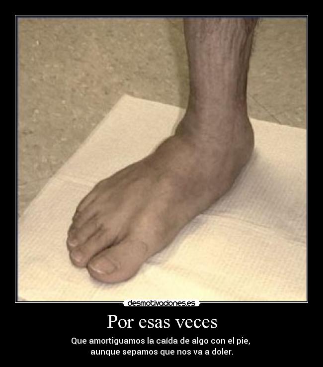 Por esas veces - Que amortiguamos la caída de algo con el pie,
aunque sepamos que nos va a doler.