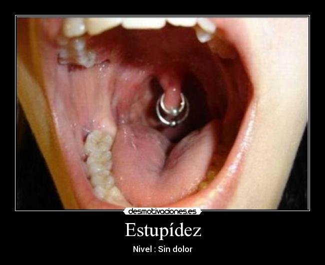 Estupídez - Nivel : Sin dolor