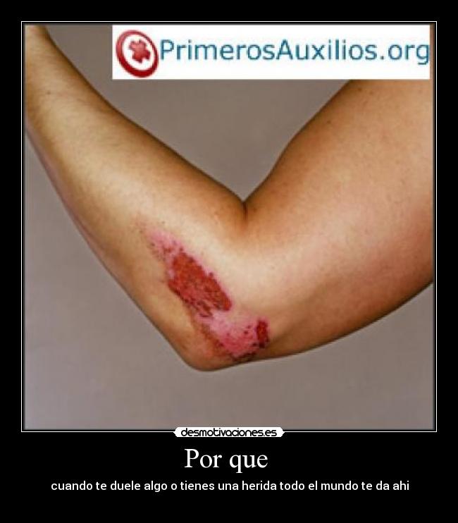 Por que - cuando te duele algo o tienes una herida todo el mundo te da ahi