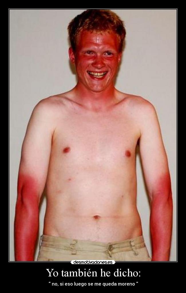 Yo también he dicho: - no, si eso luego se me queda moreno