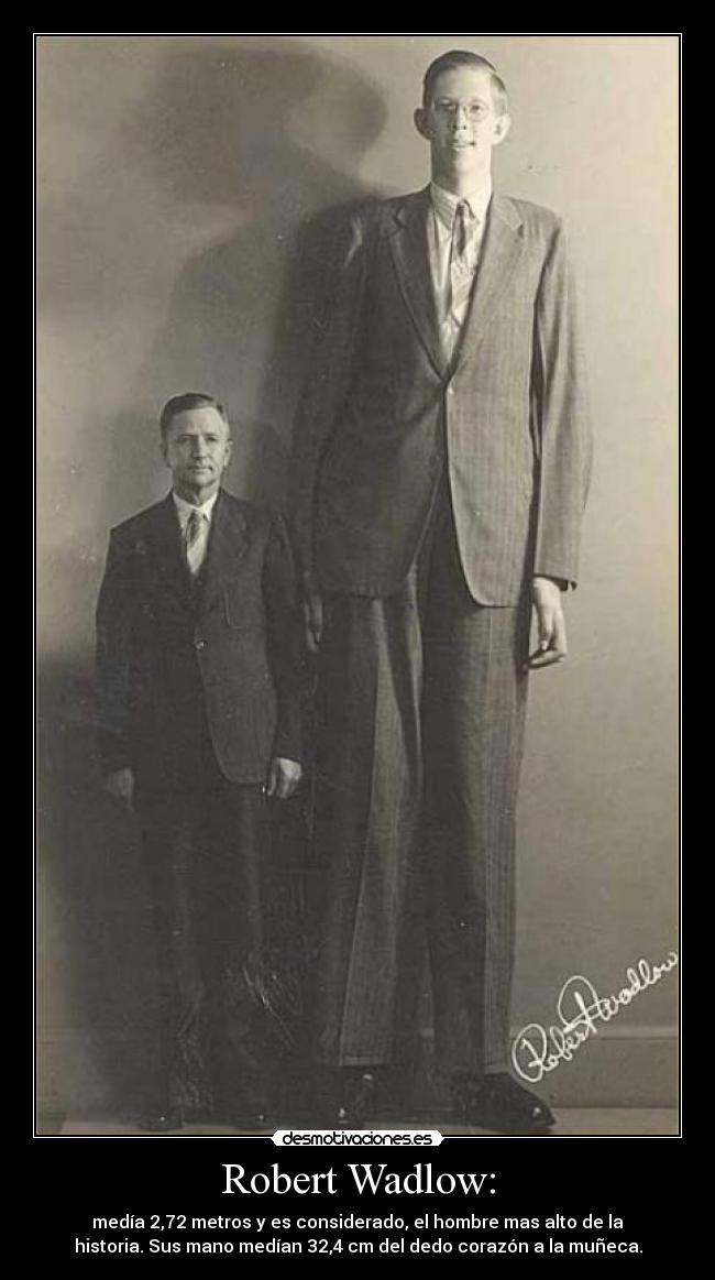 Robert Wadlow: - medía 2,72 metros y es considerado, el hombre mas alto de la
historia. Sus mano medían 32,4 cm del dedo corazón a la muñeca.