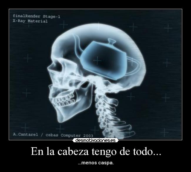 En la cabeza tengo de todo... -