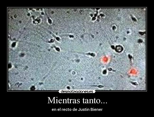 Mientras tanto... - en el recto de Justin Biener