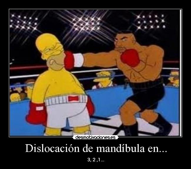 Dislocación de mandíbula en... - 3, 2 ,1...