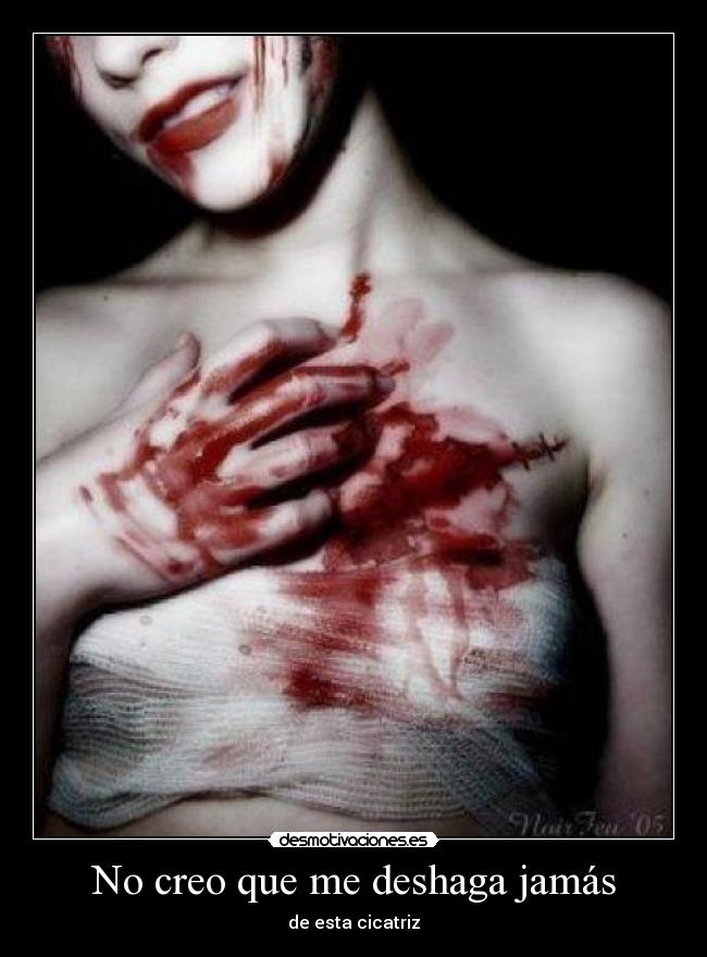 No creo que me deshaga jamás - de esta cicatriz