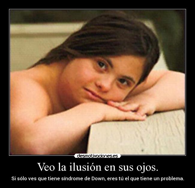 Veo la ilusión en sus ojos. - Si sólo ves que tiene síndrome de Down, eres tú el que tiene un problema.